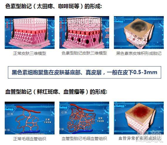 案例图片