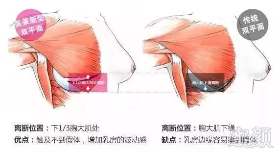 案例图片