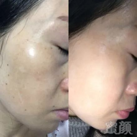 https://img.miyanlife.com/mnt/timg/181202/11315JZ2-9.jpg