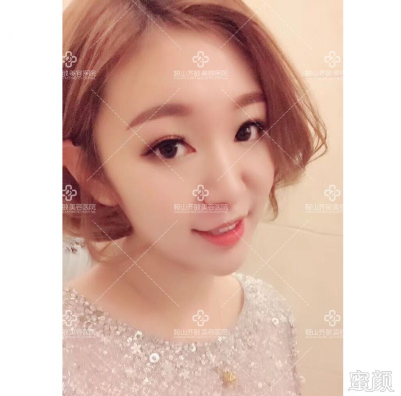 https://img.miyanlife.com/mnt/timg/181202/113AT4Q-1.jpg