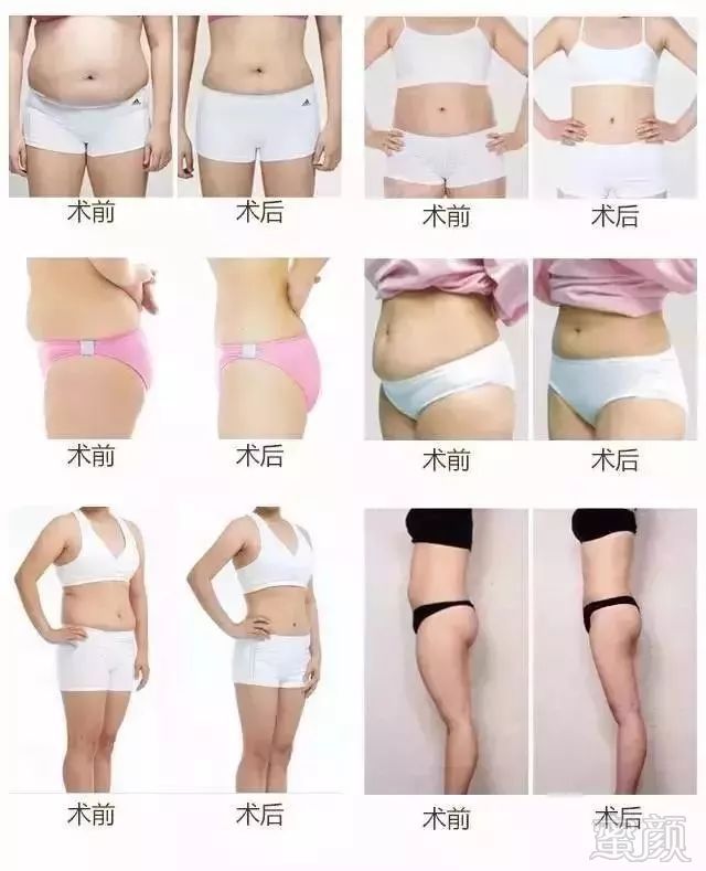 https://img.miyanlife.com/mnt/timg/181202/1232204G7-10.jpg