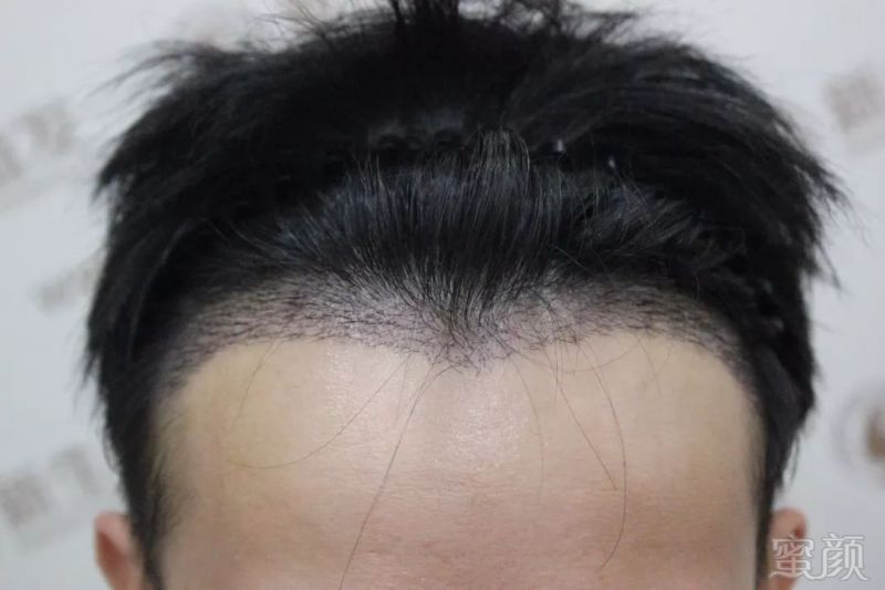 https://img.miyanlife.com/mnt/timg/181202/1239562a5-3.jpg