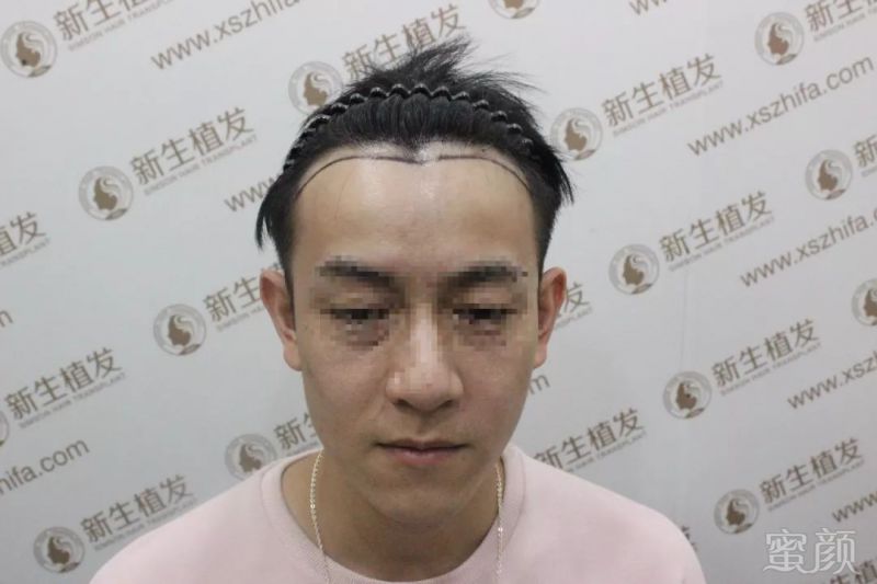 https://img.miyanlife.com/mnt/timg/181202/12395A433-1.jpg