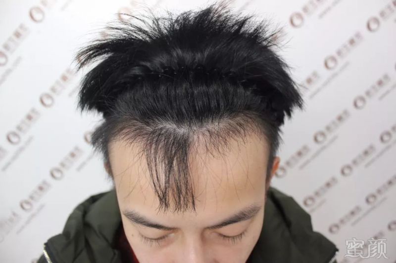 https://img.miyanlife.com/mnt/timg/181202/12395K638-5.jpg