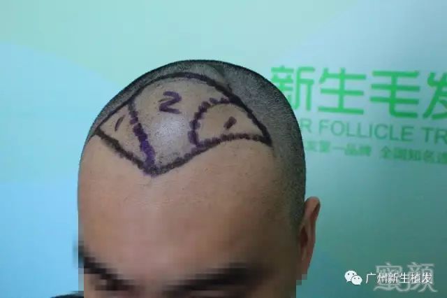 https://img.miyanlife.com/mnt/timg/181202/123Q03617-1.jpg