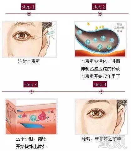 https://img.miyanlife.com/mnt/timg/181202/124Q22595-2.jpg