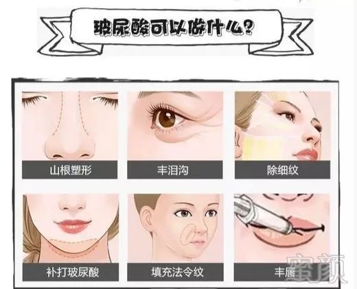 https://img.miyanlife.com/mnt/timg/181202/124Q23409-4.jpg