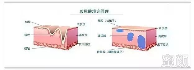 https://img.miyanlife.com/mnt/timg/181202/124Q24M5-5.jpg