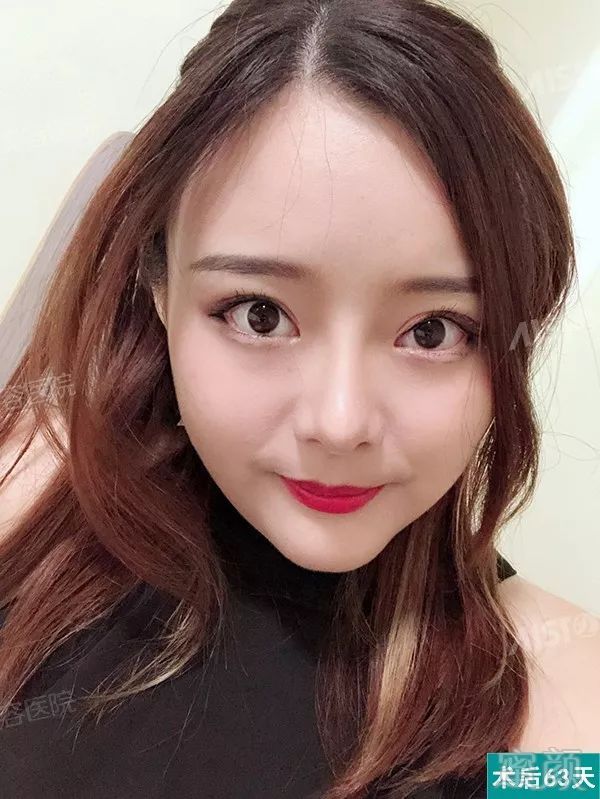 https://img.miyanlife.com/mnt/timg/181202/12541W949-6.jpg