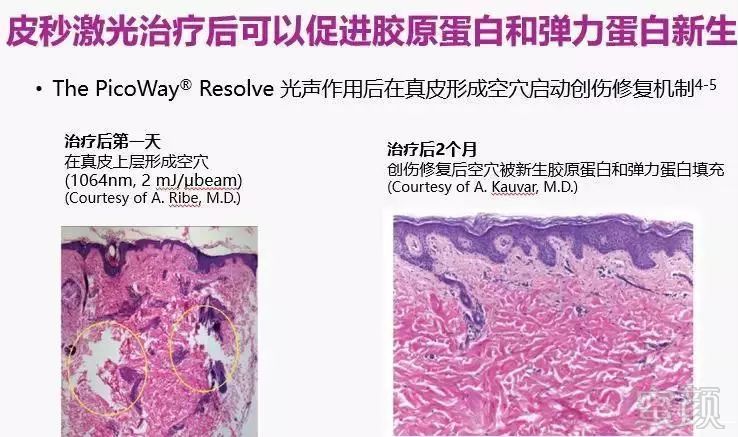 https://img.miyanlife.com/mnt/timg/181202/130300B35-8.jpg