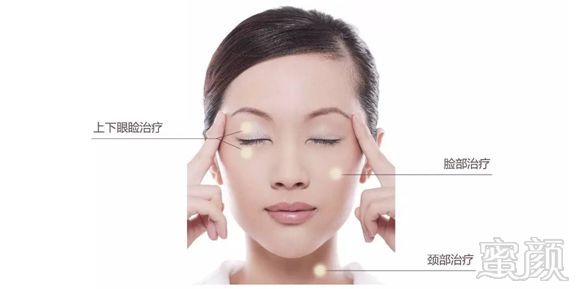 https://img.miyanlife.com/mnt/timg/181203/113K224C-11.jpg