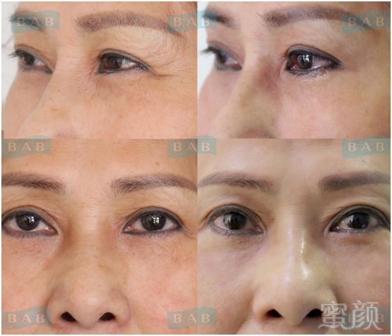 https://img.miyanlife.com/mnt/timg/181203/113K243O-15.jpg