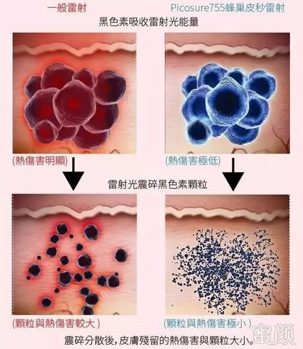 https://img.miyanlife.com/mnt/timg/181203/121RIW9-1.jpg