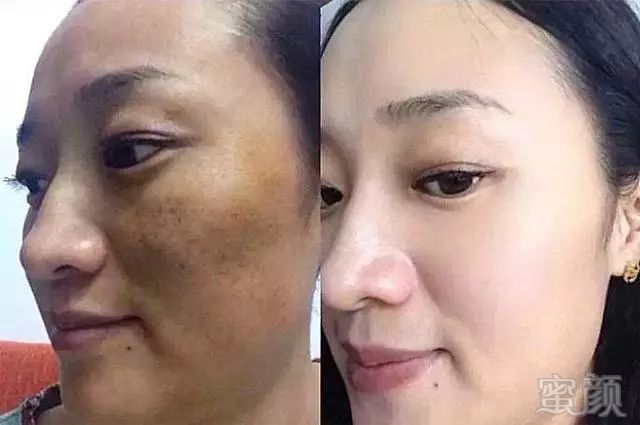 https://img.miyanlife.com/mnt/timg/181203/121RUP7-6.jpg