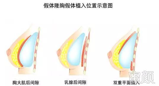 案例图片