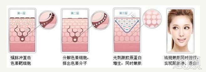 https://img.miyanlife.com/mnt/timg/181204/11163424L-2.jpg