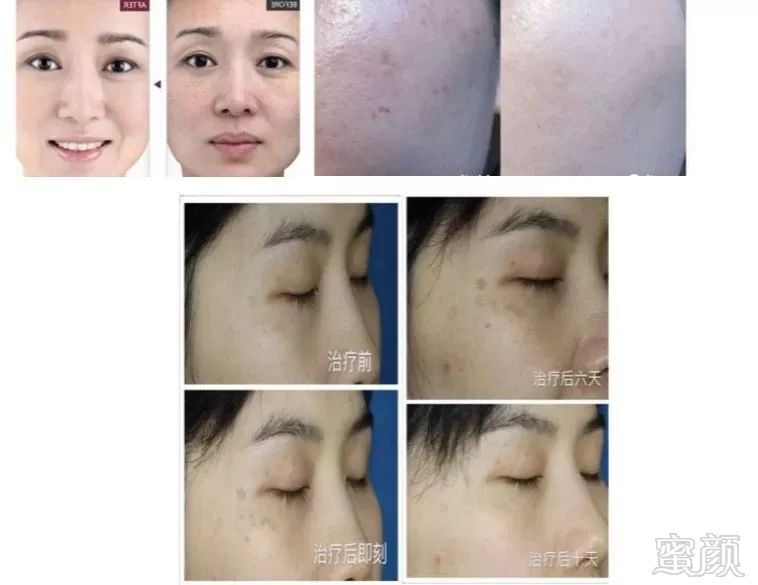 https://img.miyanlife.com/mnt/timg/181204/111KGS6-4.jpg