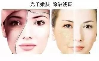 https://img.miyanlife.com/mnt/timg/181204/111KM051-3.jpg