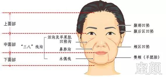 https://img.miyanlife.com/mnt/timg/181204/122K0MB-1.jpg