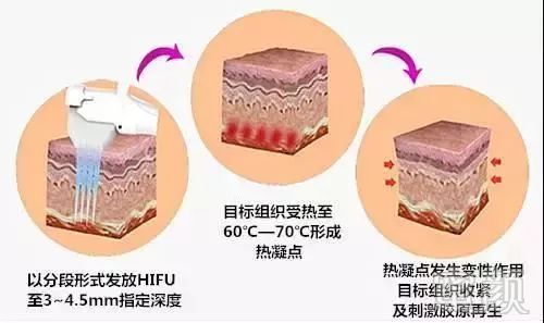 https://img.miyanlife.com/mnt/timg/181204/122K12563-5.jpg
