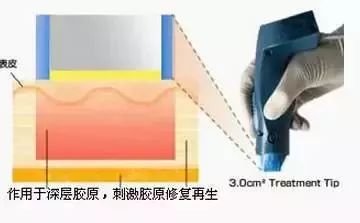 https://img.miyanlife.com/mnt/timg/181204/122K1H44-8.jpg