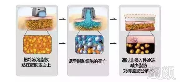 https://img.miyanlife.com/mnt/timg/181204/122S44055-5.jpg