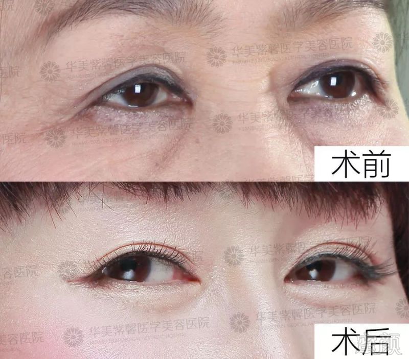 https://img.miyanlife.com/mnt/timg/181204/124R95095-6.jpg