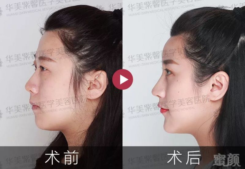 https://img.miyanlife.com/mnt/timg/181204/124RT3F-5.jpg