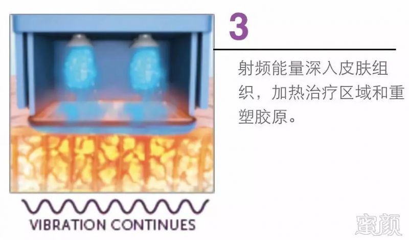 https://img.miyanlife.com/mnt/timg/181205/1226012623-3.jpg