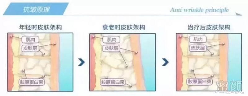 https://img.miyanlife.com/mnt/timg/181205/12260251b-6.jpg