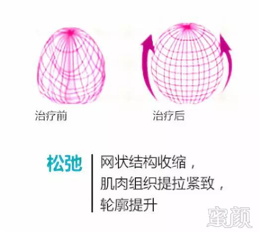https://img.miyanlife.com/mnt/timg/181205/122S12P6-13.jpg