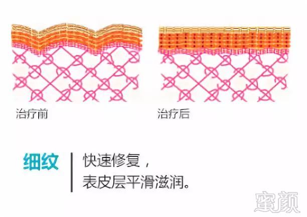 https://img.miyanlife.com/mnt/timg/181205/122S15091-11.jpg