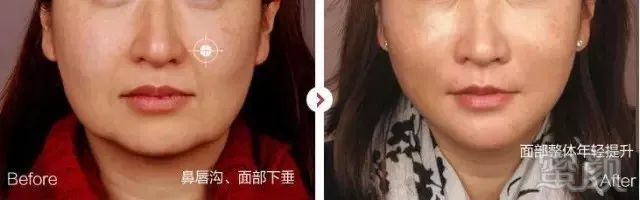 https://img.miyanlife.com/mnt/timg/181205/122S15563-7.jpg