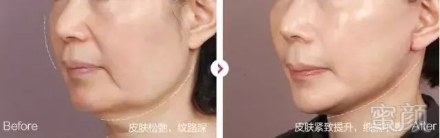 https://img.miyanlife.com/mnt/timg/181205/122S1N28-6.jpg
