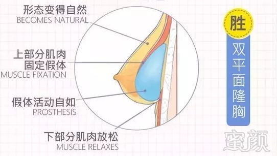 案例图片