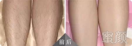 https://img.miyanlife.com/mnt/timg/181205/1241395153-2.jpg
