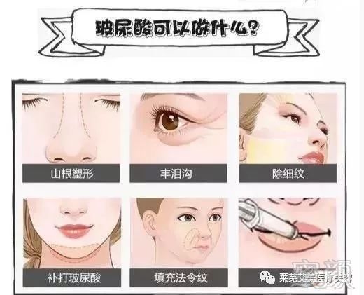 https://img.miyanlife.com/mnt/timg/181205/13112421K-2.jpg