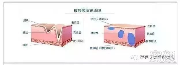 https://img.miyanlife.com/mnt/timg/181205/1311243436-3.jpg