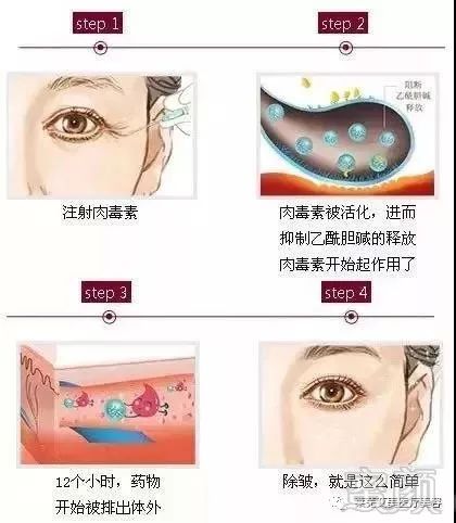https://img.miyanlife.com/mnt/timg/181205/1311244559-1.jpg