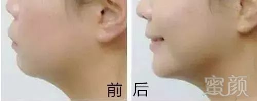 https://img.miyanlife.com/mnt/timg/181206/12161W508-6.jpg