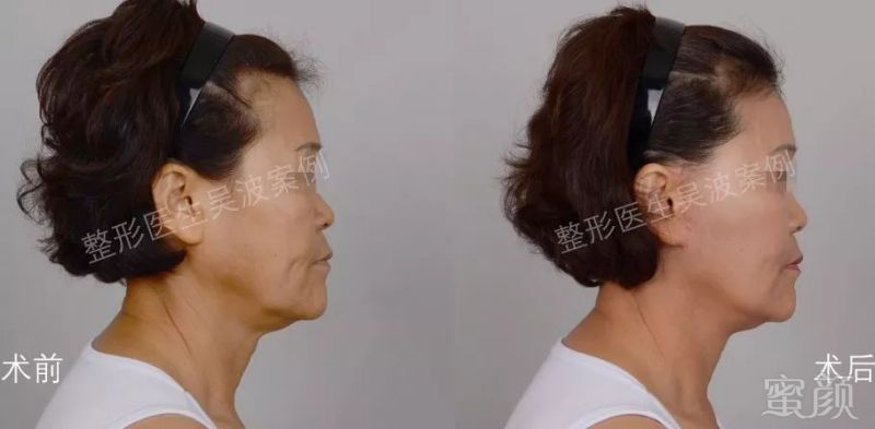 https://img.miyanlife.com/mnt/timg/181206/12555C346-5.jpg