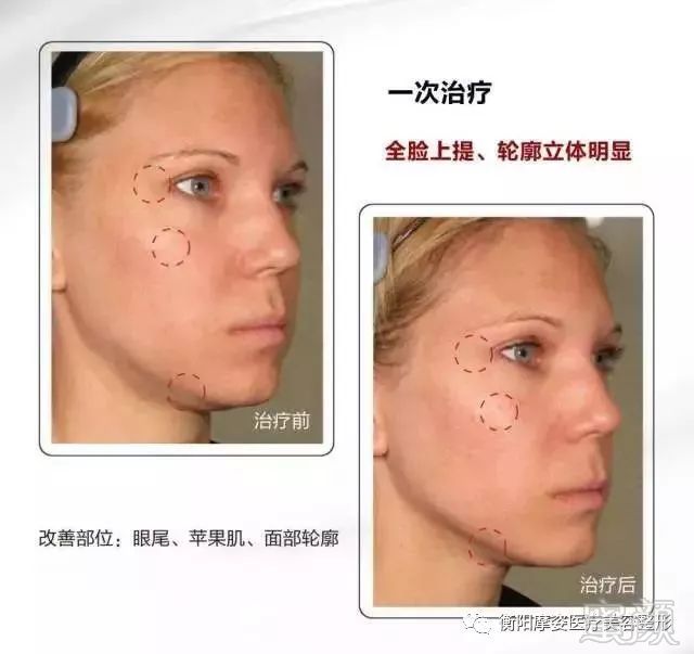 https://img.miyanlife.com/mnt/timg/181206/13243G221-5.jpg