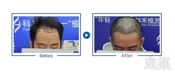 https://img.miyanlife.com/mnt/timg/181207/1152092195-2.jpg