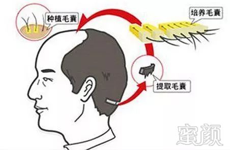 https://img.miyanlife.com/mnt/timg/181207/11595942N-3.jpg
