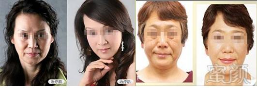 https://img.miyanlife.com/mnt/timg/181207/120F01333-2.jpg