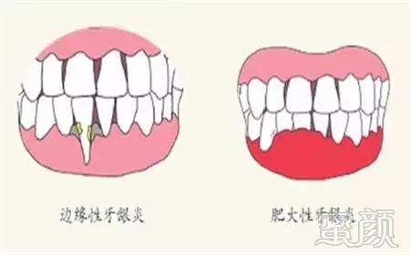 https://img.miyanlife.com/mnt/timg/181207/12224U545-3.jpg
