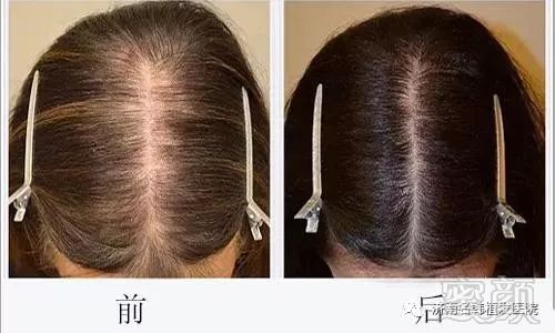 https://img.miyanlife.com/mnt/timg/181207/1233444M8-4.jpg