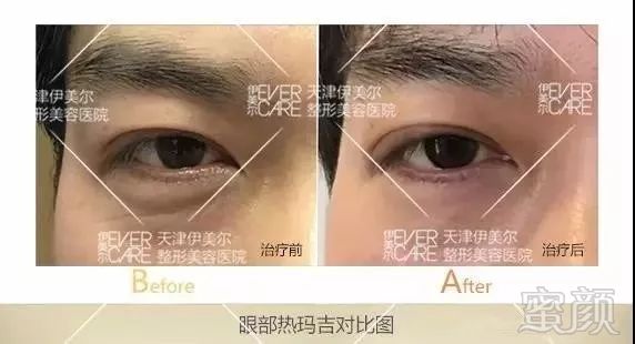 https://img.miyanlife.com/mnt/timg/181207/1252533V7-12.jpg