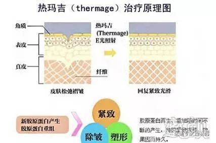 https://img.miyanlife.com/mnt/timg/181207/12553L336-6.jpg