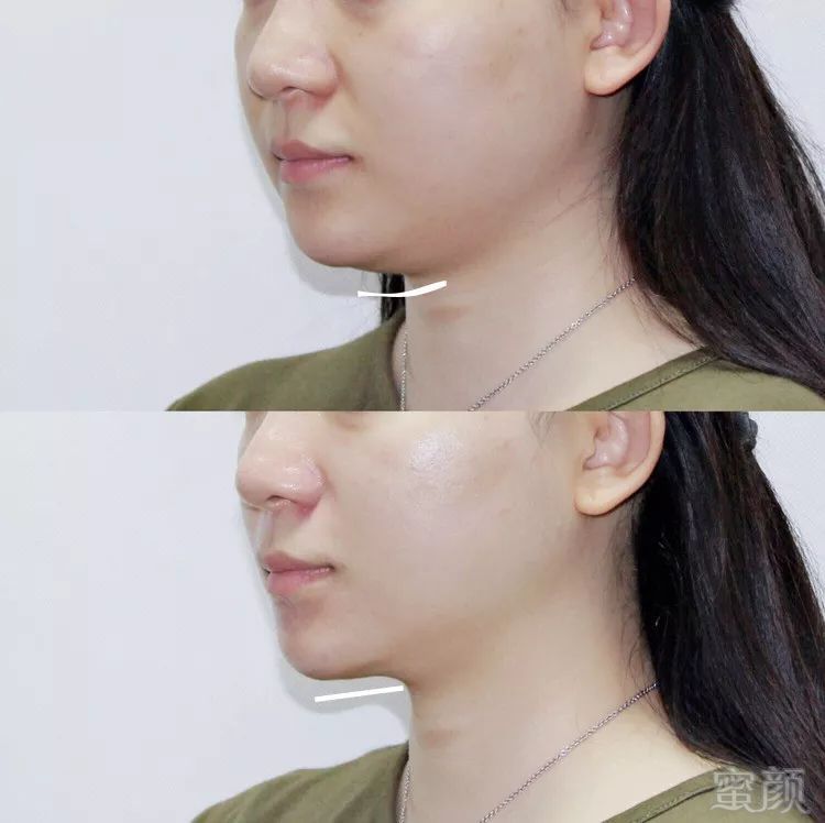 https://img.miyanlife.com/mnt/timg/181208/1312344323-15.jpg